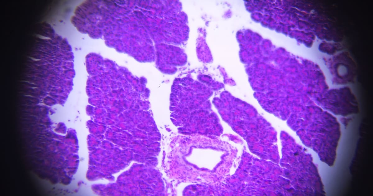 Should I Be Worried About A Pancreatic Cyst