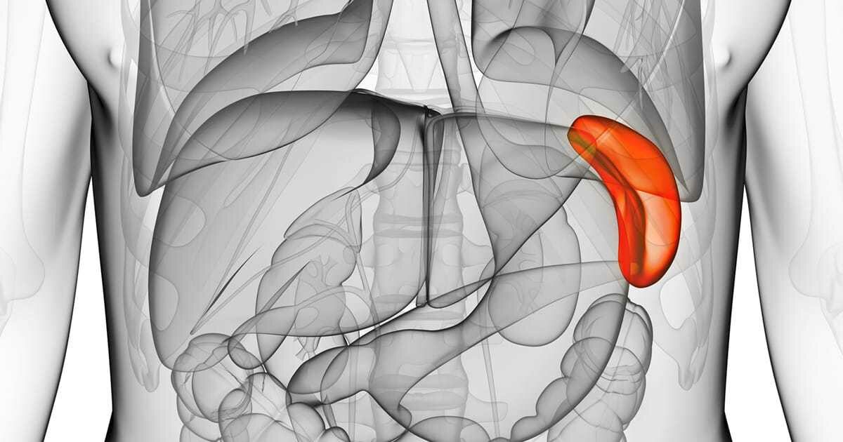 Symptoms and Causes of Enlarged Spleen (Splenomegaly)