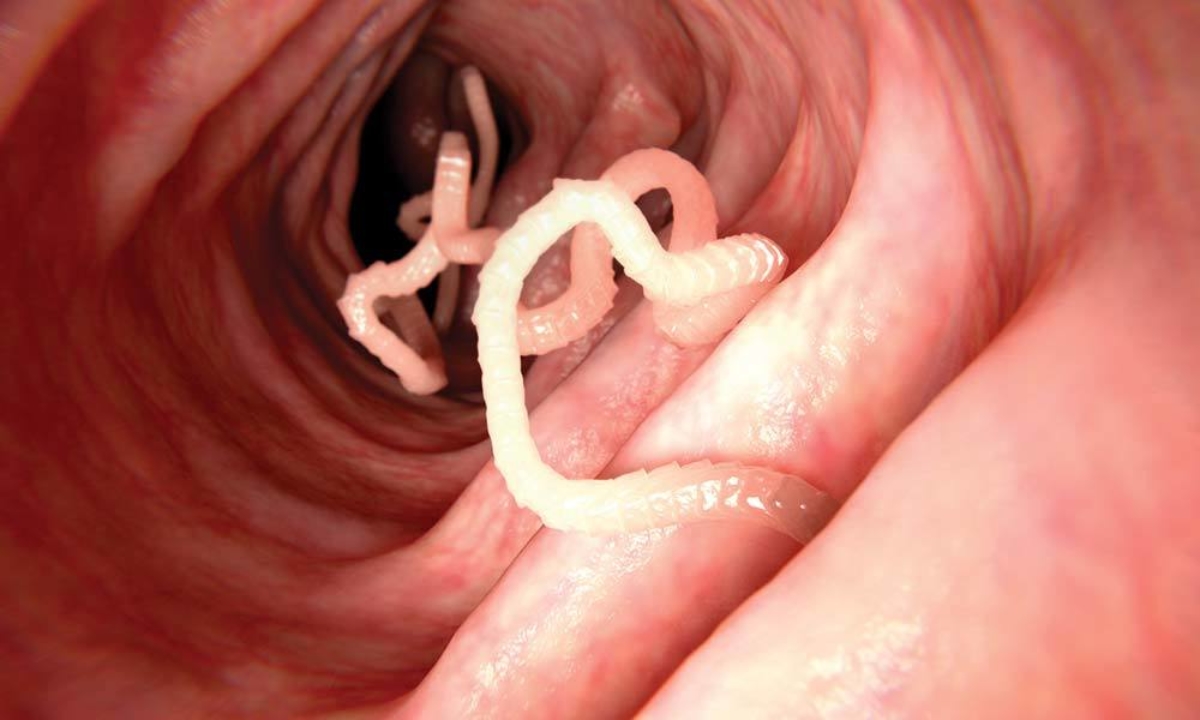 helminthiasis tapeworm stadiile de tratament a giardiozei la adulți