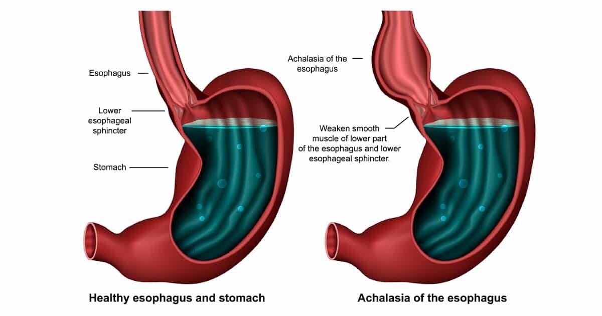 Esophagus Sphincter Anatomy Biology Diagrams