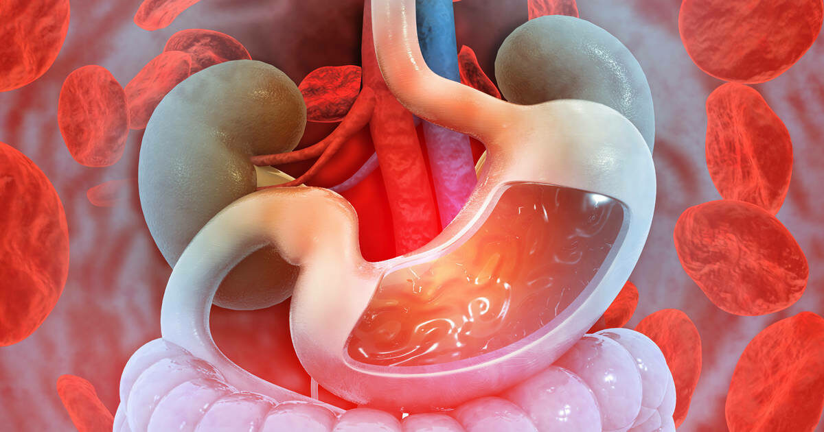 Cary Gastroenterology Associates | Possible Causes of\u2026