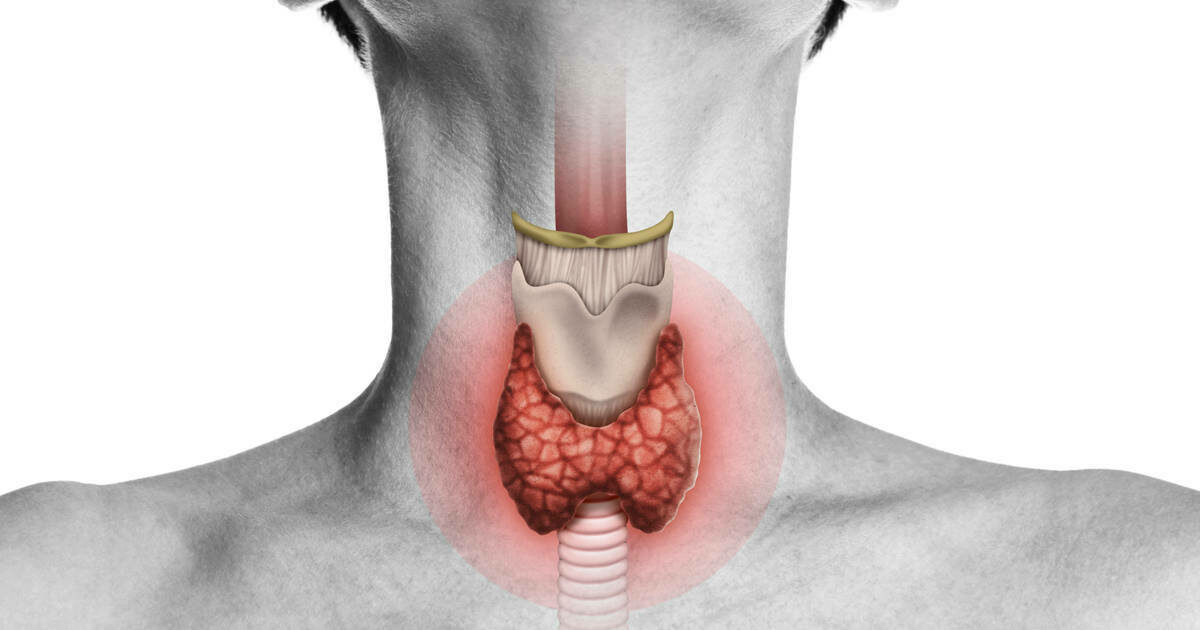 Thyroid
