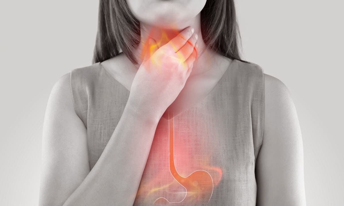 Gastroesophageal reflux disease (GERD): All you need to know!