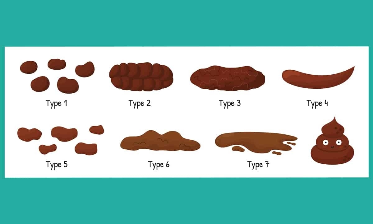 Identifying Types Of Poop With The Bristol Stool Chart And, 53% OFF