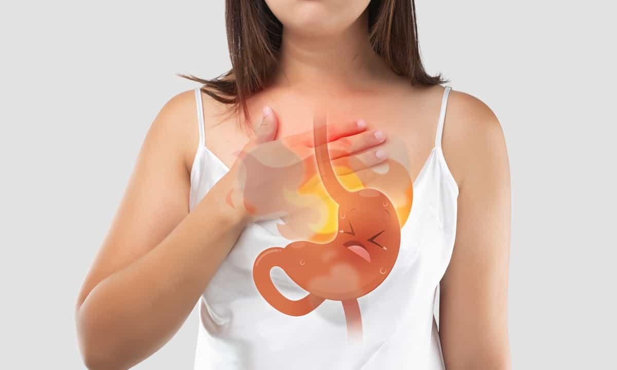 Gastroesophageal reflux disease Information | Mount Sinai - New York