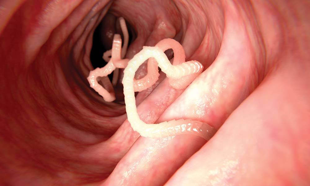 Tapeworm simptome umane și tratament, Traducere 